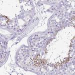 Ubiquilin 3 Antibody in Immunohistochemistry (IHC)