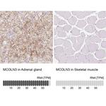 TRPML3 Antibody in Immunohistochemistry (IHC)