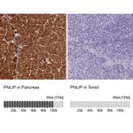 PNLIP Antibody in Immunohistochemistry (IHC)