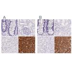 PNLIP Antibody in Immunohistochemistry (IHC)