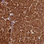 PNLIP Antibody in Immunohistochemistry (IHC)