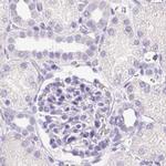 PNLIP Antibody in Immunohistochemistry (IHC)