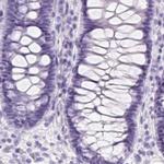 PNLIP Antibody in Immunohistochemistry (IHC)