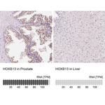 HOXB13 Antibody in Immunohistochemistry (IHC)