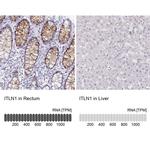 ITLN1 Antibody in Immunohistochemistry (IHC)