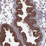 Arfaptin 1 Antibody in Immunohistochemistry (IHC)