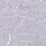 Arfaptin 1 Antibody in Immunohistochemistry (IHC)