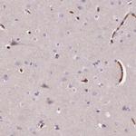 SLC4A1 Antibody in Immunohistochemistry (IHC)