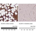 SLC4A1 Antibody