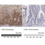 LY6D Antibody in Immunohistochemistry (IHC)