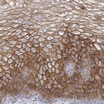 LY6D Antibody in Immunohistochemistry (IHC)