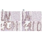 HOXB13 Antibody in Immunohistochemistry (IHC)