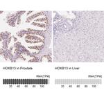 HOXB13 Antibody