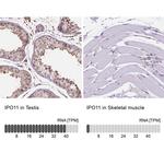 Importin 11 Antibody in Immunohistochemistry (IHC)