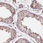 Importin 11 Antibody in Immunohistochemistry (IHC)