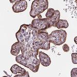 Importin 11 Antibody in Immunohistochemistry (IHC)