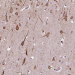 Importin 11 Antibody in Immunohistochemistry (IHC)