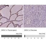 ZNF41 Antibody in Immunohistochemistry (IHC)