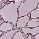 ZNF41 Antibody in Immunohistochemistry (IHC)