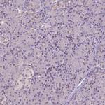 ZNF41 Antibody in Immunohistochemistry (IHC)