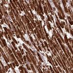 MTCO1 Antibody in Immunohistochemistry (IHC)