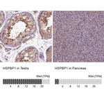 HSPBP1 Antibody in Immunohistochemistry (IHC)