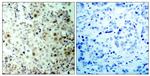 Phospho-CDK1 (Thr161) Antibody in Immunohistochemistry (Paraffin) (IHC (P))