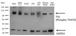 Phospho-TTK (Thr676) Antibody in Western Blot (WB)