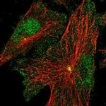 PRICKLE3 Antibody in Immunocytochemistry (ICC/IF)