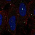 GPR137C Antibody in Immunocytochemistry (ICC/IF)