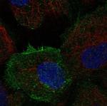 TEC Antibody in Immunocytochemistry (ICC/IF)