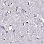 RP1L1 Antibody in Immunohistochemistry (IHC)