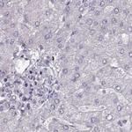 RP1L1 Antibody in Immunohistochemistry (IHC)
