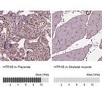 HTR1B Antibody