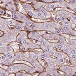 COL6A2 Antibody in Immunohistochemistry (IHC)