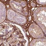 COL6A2 Antibody in Immunohistochemistry (IHC)