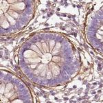 COL6A2 Antibody in Immunohistochemistry (IHC)