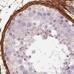 COL6A2 Antibody in Immunohistochemistry (IHC)