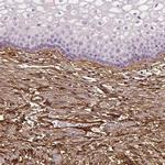 COL6A2 Antibody in Immunohistochemistry (IHC)