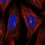 Jouberin Antibody in Immunocytochemistry (ICC/IF)