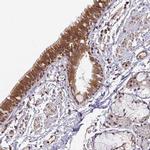 SIMC1 Antibody in Immunohistochemistry (IHC)