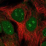 SIMC1 Antibody in Immunocytochemistry (ICC/IF)