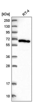 ACOT11 Antibody in Western Blot (WB)