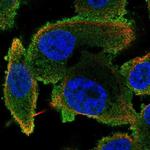 PLCB2 Antibody in Immunocytochemistry (ICC/IF)