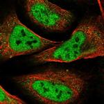 WHSC2 Antibody in Immunocytochemistry (ICC/IF)