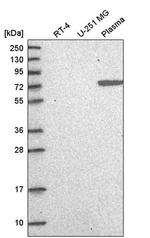 MCM8 Antibody in Western Blot (WB)