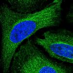 ADAL Antibody in Immunocytochemistry (ICC/IF)