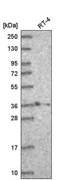 HOXB2 Antibody in Western Blot (WB)