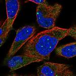 TPP2 Antibody in Immunocytochemistry (ICC/IF)