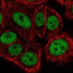 BRF1 Antibody in Immunocytochemistry (ICC/IF)